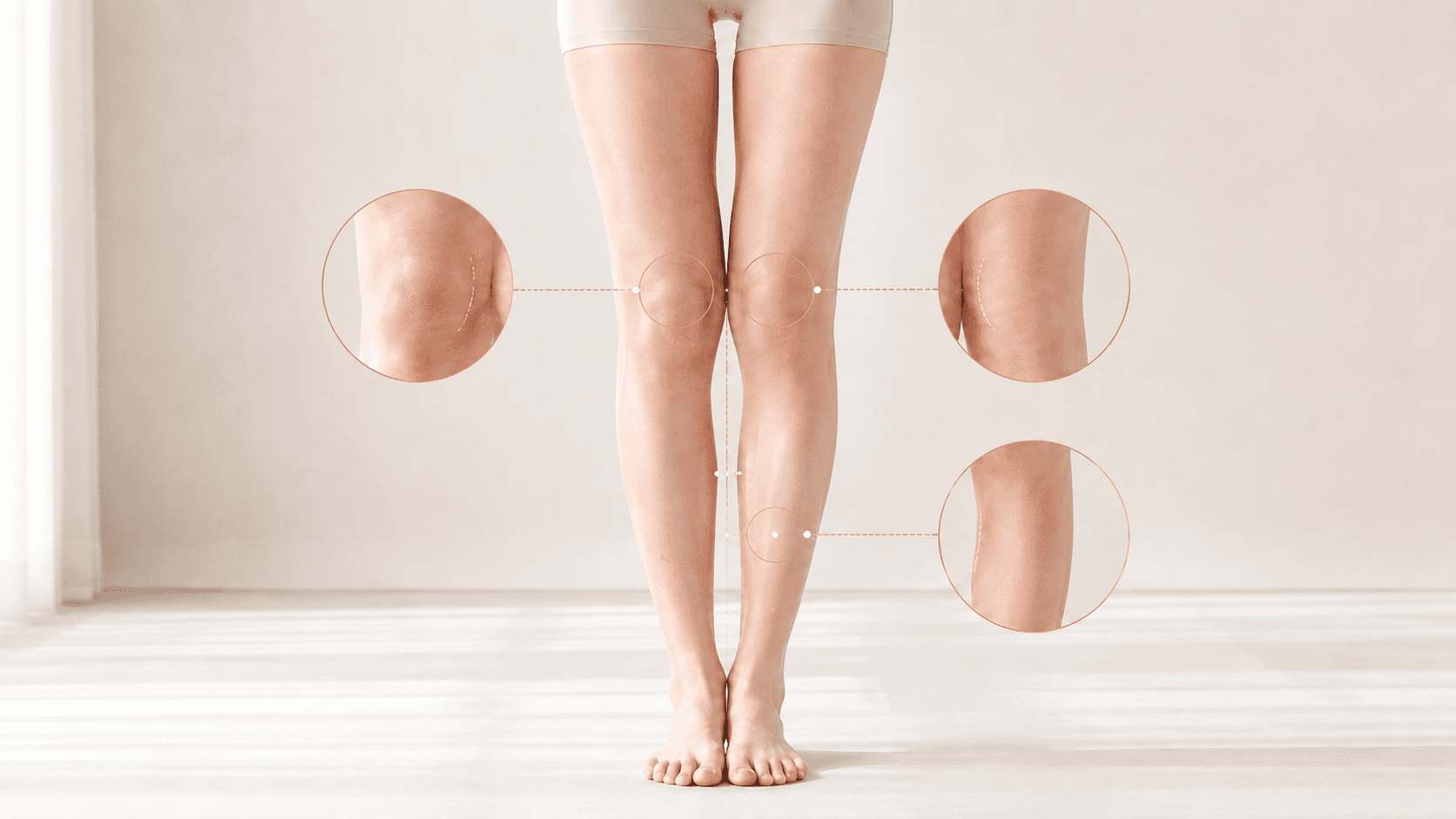 무릎과 종아리 주변 피부 표면의 지방 분포와 요철을 확대해 보여 주는 분석 이미지