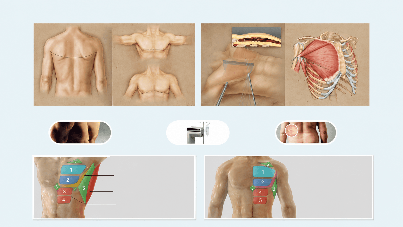 Pectoral design method infographic — lower border, lateral line and upper-abdomen connection