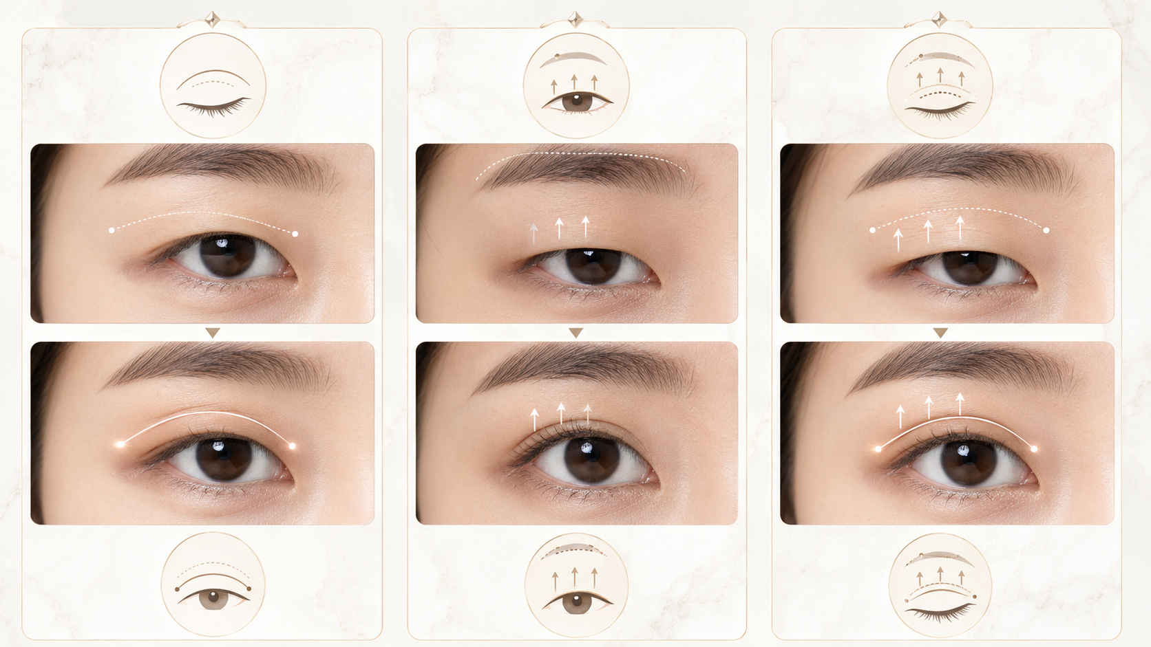 睁眼力量调整 — 睁眼改善设计概念